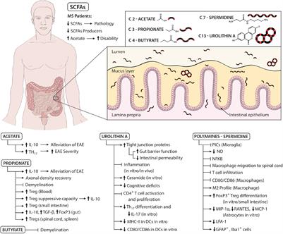 Microbial Metabolites in Multiple Sclerosis: Implications for Pathogenesis and Treatment